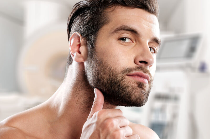 Beard Transplant: A Comprehensive Guide to Fuller Facial Hair