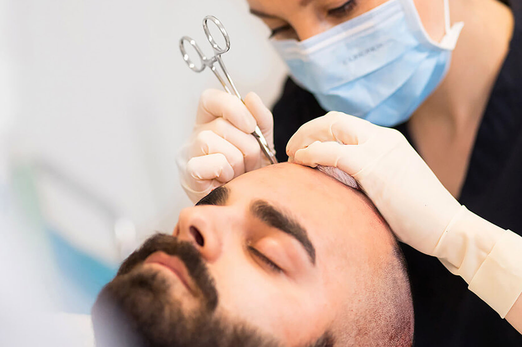 Hair Transplant: Comprehensive Guide to Procedures, Care, and Recovery